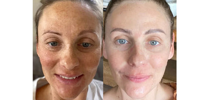 Korean Skincare Cream