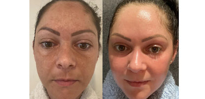 Korean Skincare Cream